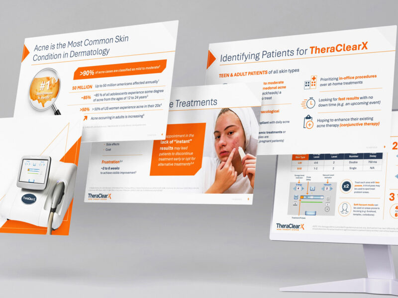 theraclearx slides